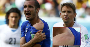 Il morso di Suarez a Chiellini