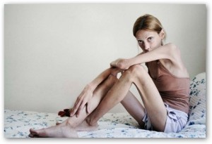 foto_anoressia_toscanini